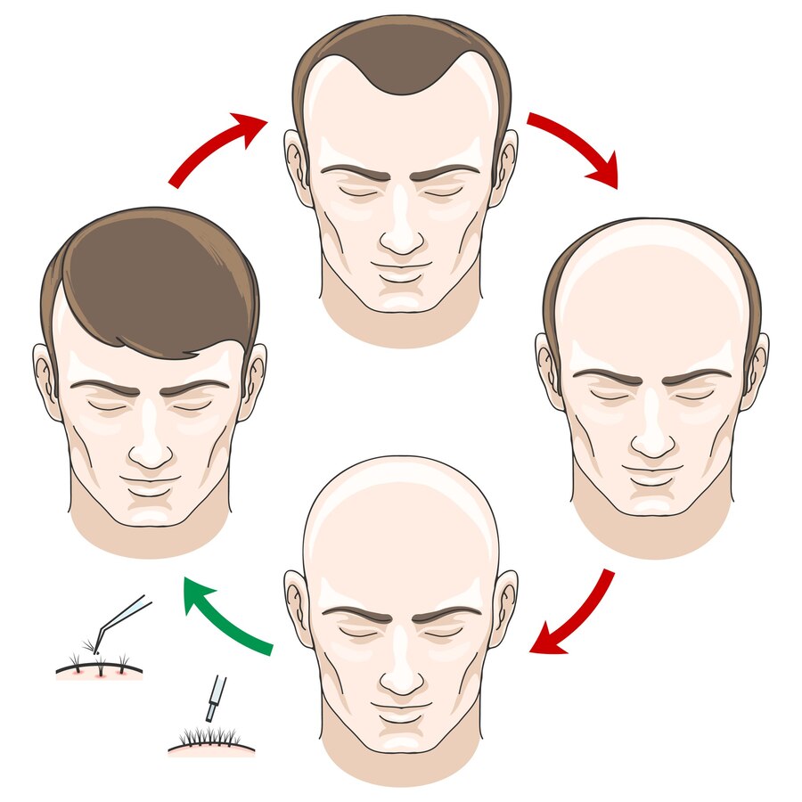 hair loss treatment